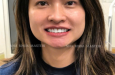 NHA KHOA MASTERI 