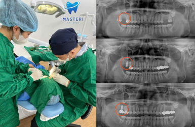 Địa Chỉ Cấy Ghép Implant Uy Tín Tại TP.HCM