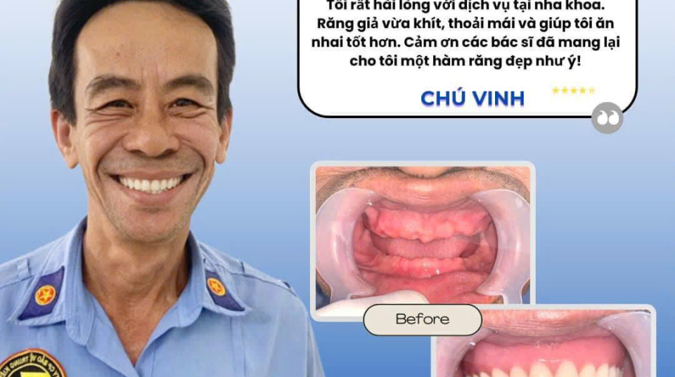 HÌNH ẢNH THỰC TẾ KHÁCH HÀNG SỬ DỤNG DỊCH VỤ HÀM GIẢ THÁO LẮP
