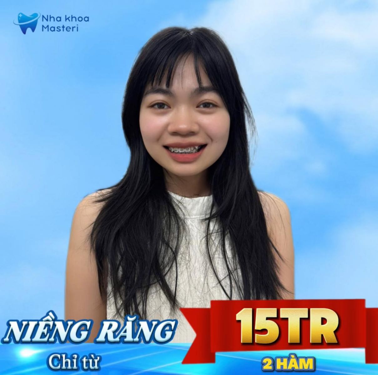 Niềng Răng Thẩm Mỹ Tại Thủ Đức